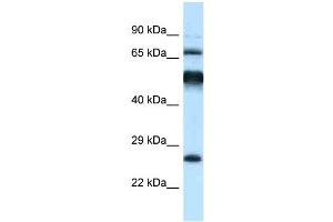WB Suggested Anti-Klhl1 Antibody Titration: 1. (KLHL1 anticorps  (C-Term))