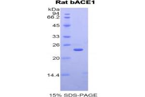 SDS-PAGE analysis of Rat bACE1 Protein. (BACE1 Protéine)