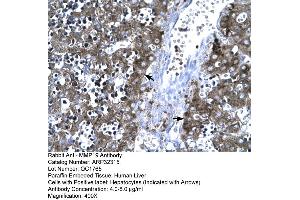 Human Liver (MMP19 anticorps  (C-Term))