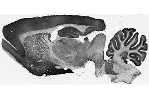 Adult rat brain immunohistochemistry.