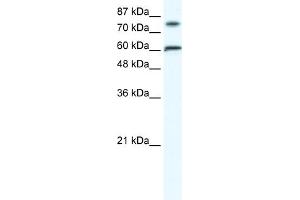 WB Suggested Anti-FLJ23436 Antibody Titration:  1. (ZNF768 anticorps  (N-Term))