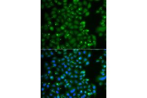 Immunofluorescence analysis of A549 cell using ANXA11 antibody. (Annexin A11 anticorps)