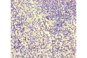 Immunohistochemistry of paraffin-embedded human spleen tissue using ABIN7156438 at dilution of 1:100