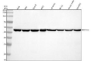 Western blot analysis of BCL2L14 using anti-BCL2L14 antibody (ABIN7604110).