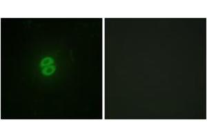 Immunofluorescence analysis of A549 cells, using CD253 Antibody. (TRAIL anticorps  (AA 31-80))