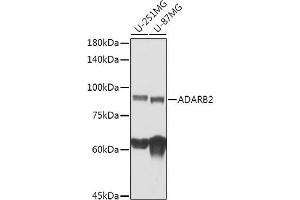 Western blot analysis of extracts of various cell lines, using  antibody (ABIN7265460) at 1:1000 dilution. (ADARB2 anticorps)