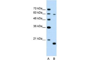 WB Suggested Anti-SLC38A4 Antibody Titration:  2. (SLC38A4 anticorps  (Middle Region))