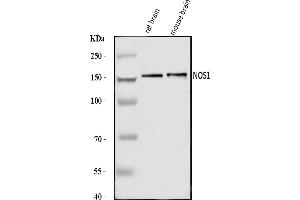 Western blot analysis of nNOS (neuronal)/NOS1 using anti-nNOS (neuronal)/NOS1 antibody (ABIN7600399).