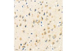 Immunohistochemistry of paraffin embedded mouse brain using rasgrf1 (ABIN7073422) at dilution of 1:4000 (400x lens) (Cdc25 anticorps)