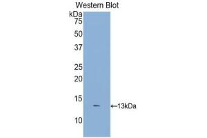 Detection of Recombinant DKK2, Human using Polyclonal Antibody to Dickkopf Related Protein 2 (DKK2) (DKK2 anticorps  (AA 159-258))