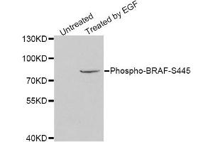 Western blot analysis of extracts of HeLa cell line, using Phospho-BRAF-S445 antibody.