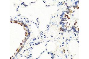 Immunohistochemistry of paraffin-embedded Rat lung using NTF3 Polyclonal Antibody at dilution of 1:100 (40x lens). (Neurotrophin 3 anticorps)