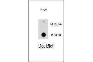 Dot blot analysis of anti-Phospho-MEK1 Pab (ABIN389590 and ABIN2839607) on nitrocellulose membrane.
