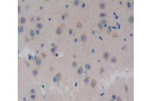 Used in DAB staining on fromalin fixed paraffin- embedded Kidney tissue