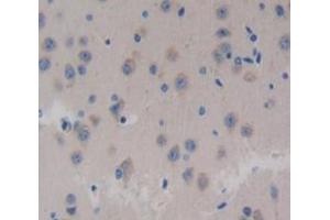 Used in DAB staining on fromalin fixed paraffin- embedded Kidney tissue (Neurocan anticorps  (AA 960-1225))