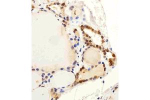Immunohistochemical analysis of paraffin-embedded H. (C13orf30 anticorps  (C-Term))