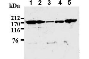 Western Blotting (WB) image for anti-IQ Motif Containing GTPase Activating Protein 1 (IQGAP1) antibody (ABIN487492) (IQGAP1 anticorps)
