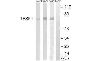 Western blot analysis of extracts from rat heart cells, rat kidney cells and rat liver cells, using TESK1 antibody. (TESK1 anticorps)