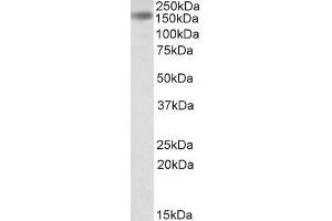 Western Blotting (WB) image for anti-Drosha, Ribonuclease Type III (DROSHA) antibody (ABIN5927621) (DROSHA anticorps)