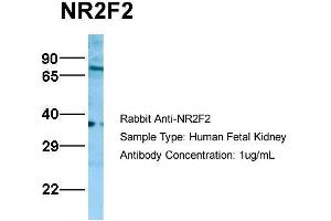 Host:  Rabbit  Target Name:  NR2F2  Sample Type:  Human Fetal Kidney  Antibody Dilution:  1. (NR2F2 anticorps  (N-Term))