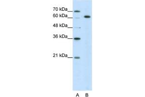 Western Blotting (WB) image for anti-Small Nuclear Ribonucleoprotein 70kDa (U1) (SNRNP70) antibody (ABIN2462077) (SNRNP70 anticorps)