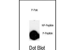 Dot blot analysis of anti-Phospho-LINGO-1(LRRN6A)-p Pab (ABIN650826 and ABIN2839798) on nitrocellulose membrane. (LINGO1 anticorps  (pSer596))