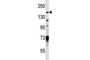 Hamartin antibody western blot analysis in MDA-MB231 lysate (TSC1 anticorps  (AA 401-430))