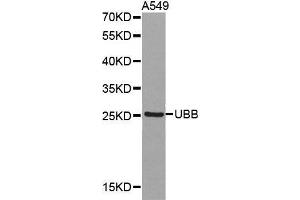 Western blot analysis of extracts of A549 cell lines, using UBB antibody. (Ubiquitin B anticorps  (AA 1-76))