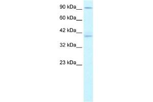 KIFC2 antibody used at 1. (KIFC2 anticorps  (N-Term))