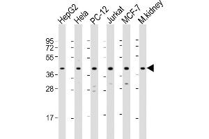 All lanes : Anti-PK14 Antibody  at 1:2000 dilution Lane 1: HepG2 whole cell lysate Lane 2: Hela whole cell lysate Lane 3: PC-12 whole cell lysate Lane 4: Jurkat whole cell lysate Lane 5: MCF-7 whole cell lysate Lane 6: mouse kidney lysate Lysates/proteins at 20 μg per lane.