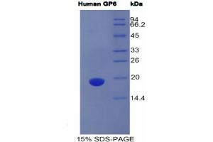 SDS-PAGE analysis of Human GP6 Protein. (GP6 Protéine)