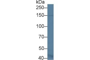 Western Blot; Sample: Mouse Kidney lysate; Primary Ab: 1µg/ml Rabbit Anti-Mouse ASK1 Antibody Second Ab: 0.
