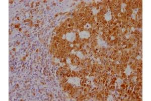 IHC image of ABIN7180562 diluted at 1:100 and staining in paraffin-embedded human tonsil tissue performed on a Leica BondTM system.