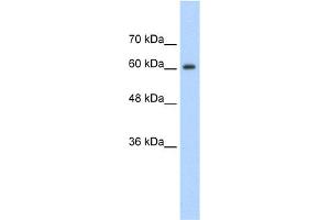 WB Suggested Anti-SYNCRIP Antibody Titration:  1. (SYNCRIP anticorps  (Middle Region))