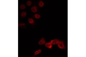 ABIN6266719 staining Hela by IF/ICC. (LMX1B anticorps  (Internal Region))