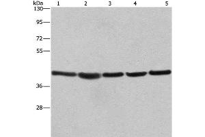 Western Blot analysis of A549, NIH/3T3 and 293T cell,Human hepatocellular carcinoma tissue and hela cell using RPSA Polyclonal Antibody at dilution of 1:433. (RPSA/Laminin Receptor anticorps)