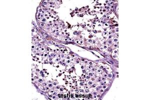 Immunohistochemistry (IHC) image for anti-Cancer/testis Antigen 2 (CTAG2) antibody (ABIN2997526) (CTAG2 anticorps)