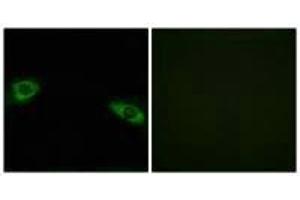 Immunofluorescence analysis of HuvEc cells, using RPS4Y1 antibody. (RPS4Y1 anticorps  (C-Term))