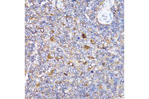 Immunohistochemistry of paraffin-embedded rat spleen using TOLLIP antibody (ABIN5971228) at dilution of 1/100 (40x lens). (TOLLIP anticorps)