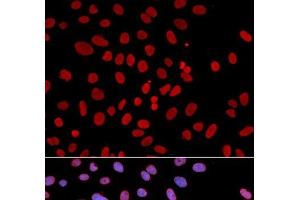 Immunofluorescence analysis of U2OS cells using PTPN6 Polyclonal Antibody (SHP1 anticorps)