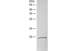 Western Blotting (WB) image for Chemokine (C-C Motif) Ligand 27 (CCL27) (AA 26-120) protein (His tag) (ABIN7122294)