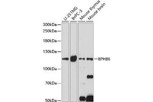 Western blot analysis of extracts of various cell lines, using EPHB6 antibody (ABIN7266973) at 1:1000 dilution. (EPH Receptor B6 anticorps  (AA 615-729))