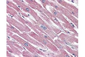 Heart, Human: Formalin-Fixed Paraffin-Embedded (FFPE) using Somatostatin Receptor 5 antibody. (SSTR5 anticorps  (2nd Extracellular Domain))
