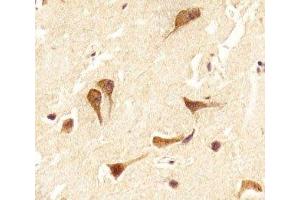 IHC analysis of FFPE human brain section using OTX2 antibody; Ab was diluted at 1:25. (OTX2 anticorps  (C-Term))