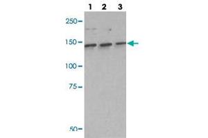 Western blot analysis of lane 1: A549 cell lysate, lane 2: H460 cell lysate and lane 3: H1703 cell lysate using IARS polyclonal antibody . (IARS anticorps)
