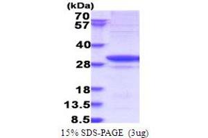 Glycyl-tRNA Synthetase (GARS) (AA 43-289) protein (His tag)