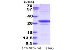SDS-PAGE (SDS) image for Glycyl-tRNA Synthetase (GARS) (AA 43-289) protein (His tag) (ABIN7280733)