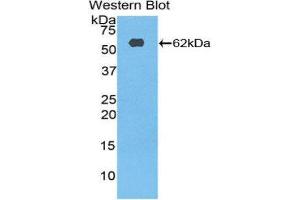 Western Blotting (WB) image for anti-Ribosomal Protein S6 Kinase, 70kDa, Polypeptide 2 (RPS6KB2) (AA 194-453) antibody (ABIN3210026) (RPS6KB2 anticorps  (AA 194-453))