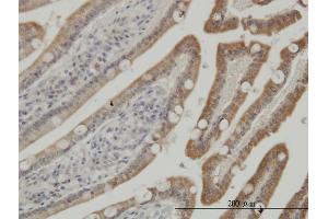 Immunoperoxidase of monoclonal antibody to CSNK1G1 on formalin-fixed paraffin-embedded human small Intestine.