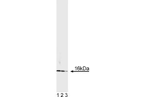 Western Blotting (WB) image for anti-Superoxide Dismutase 1, Soluble (SOD1) antibody (ABIN967513) (SOD1 anticorps)